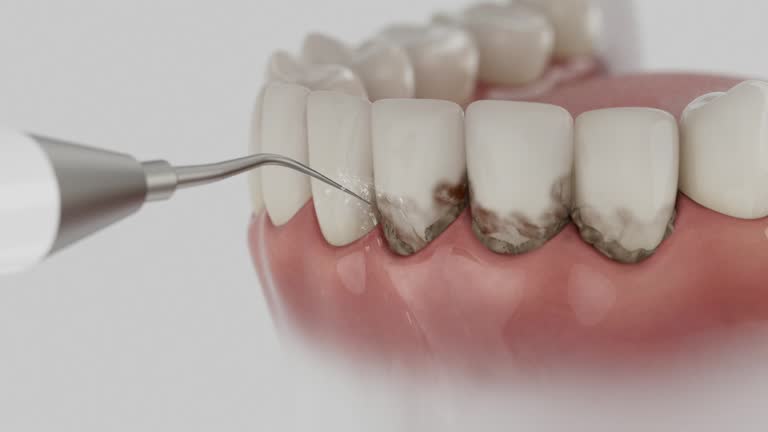 Reliable Emergency Dentist contractor in Daniel, UT by Smile Center Dentistry